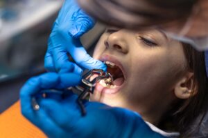 Affordable Dental Implants in Kolkata